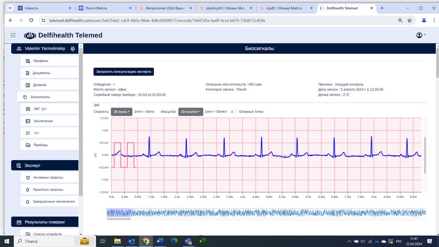 DelfiHealth Telemed interface: ECG displayed on a millimetre grid